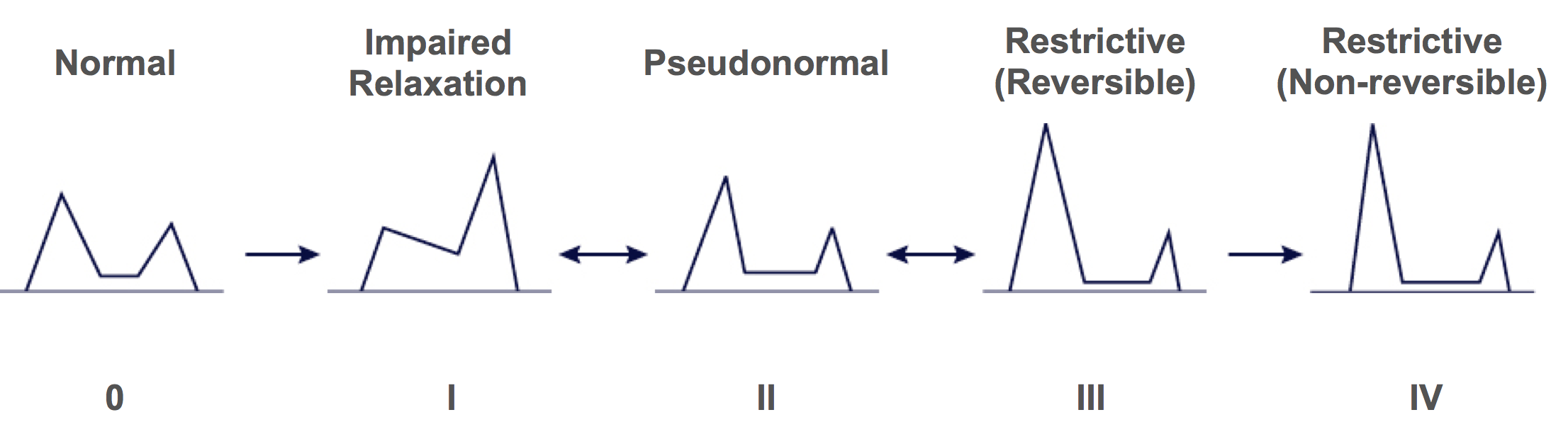 4.4 How to assess diastolic function | 123sonography